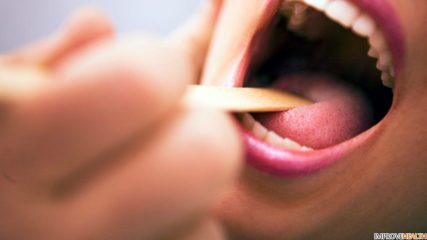 Почему возникает катаральная ангина и как ее лечить?